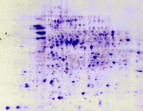 Half of a DryGel-2D with Hot Coomassie