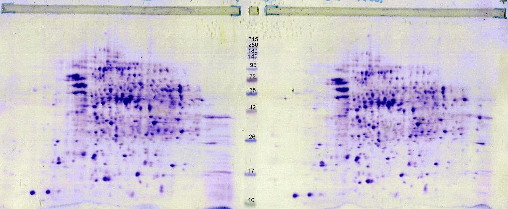 WetGel 2D small, Coomassie, mol-weight standard