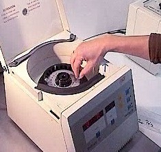After the centrifugation