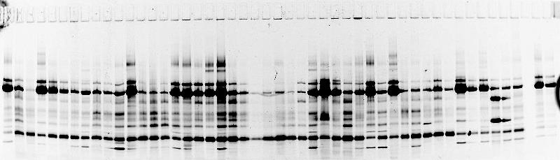 Gradient Urin Prelabel