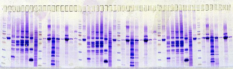 Urinary Protein Kit SDS