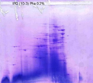 Direct Coomassie Staining without the additional washing steps