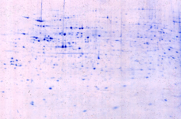 SDSGel DALT 12.5% Colloidal stained