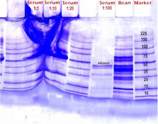 Sample too high concentrated