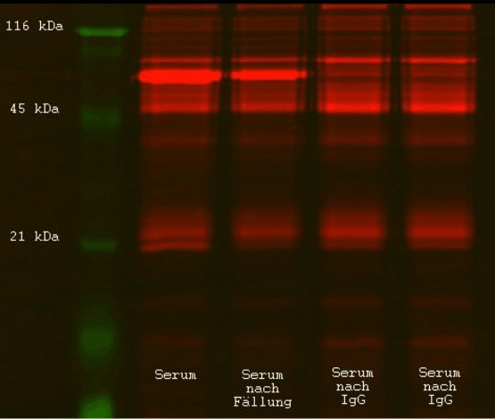 TRex 310 1D Electrophoresis