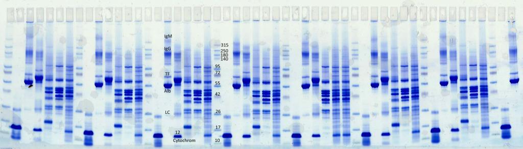 Urinary Protein Kit Gradient