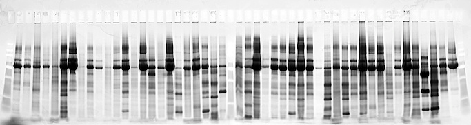 Urinary proteins prelabeled