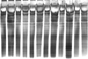Oligo-IgG IEF