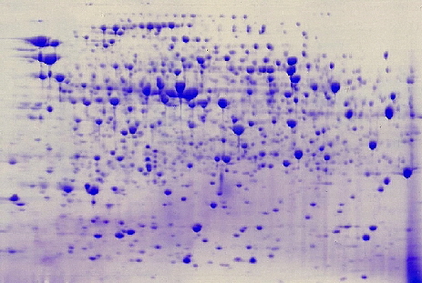 ElphoGel 2D EQ-type, on PET-film, Coomassie staining