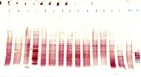 Oligo-IgG, MS-Diagnosis via IEF; E.Dubois (Neurology Tbingen)