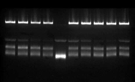 Anti-Doping: Epoetins, SAR-Electrophoresis Kit, 25 samples