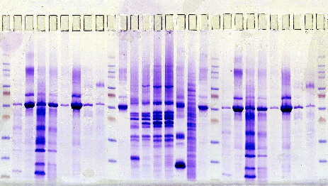 Urinary Protein Kit, SDS, Coomassie, 2 x 52 samples