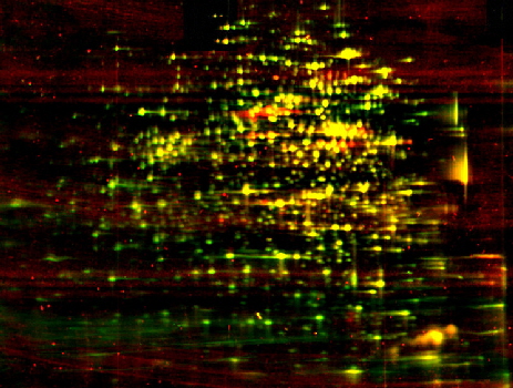 ElphoGel 2D EQ-type on PX-film, fluorescence staining