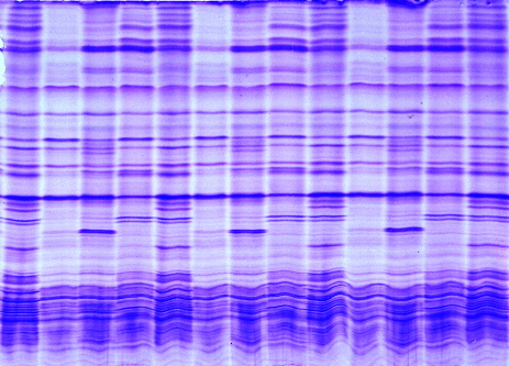 Potatoe varieties on IEFGel, SoftGel EQ-type