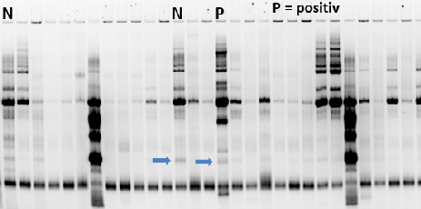 Urinary Protein Kit, SDS, Fluorescence, 2 x 52 samples