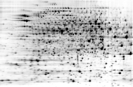 ElphoGel 2D EQ-type on PET-film, silver-stained