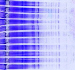 pH5.5 EColi